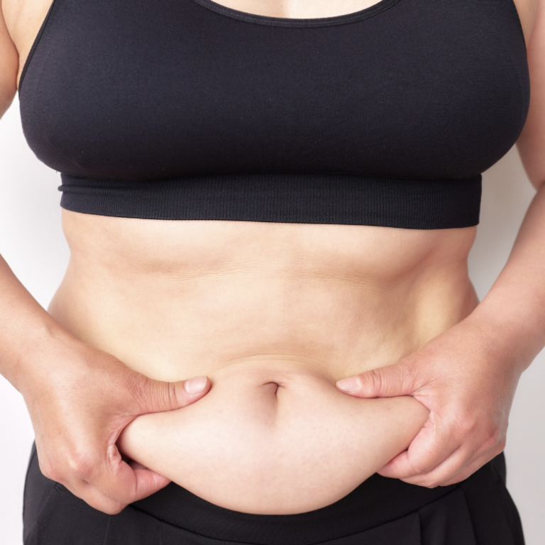 Full Tummy Tuck Best Prices Near Alexandria VA